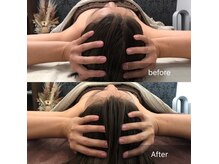 頭の浮腫み、小顔も叶う小顔ヘッドスパ