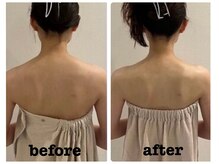 ビオール 新宿店(beall)の雰囲気（beallオリジナル首肩凝り施術お試し下さい♪首肩凝り/姿勢改善）