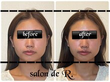 サロン ド アール(salon de R.)の雰囲気（どうにかしたい！頬の余白もこんなに引き締まる!R.小顔メソッド）