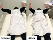 ソレア(Solea)/ブライダル肩甲骨改善3回目