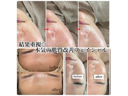 リノ(Lino)の写真