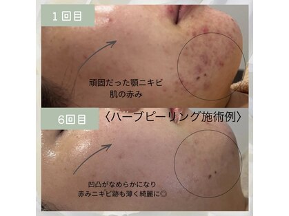 ルミエール 札幌大通parkside店の写真