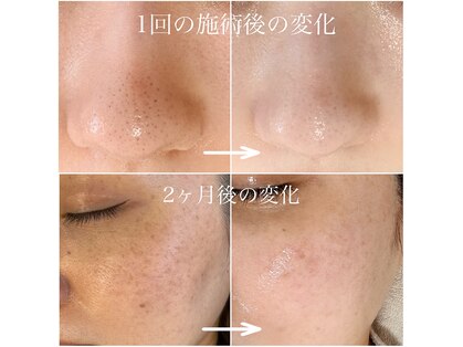 サラシック(salachic)の写真