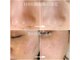 サラシック(salachic)の写真