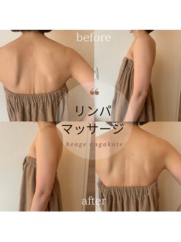 ビアージュ ナガクテ(Beage nagakute)/リンパマッサージ＋ストレッチ