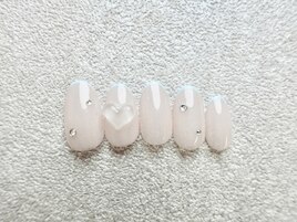 トレンド定額
