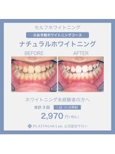 ホワイトニングビューティー 村上店(Whitening Beauty)/ナチュラルホワイトニング