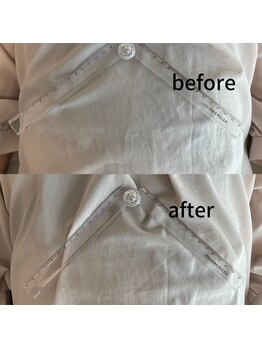 すまいむ整体院/肋骨矯正