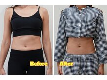 アズール(azure)/ダイエットにお薦め、骨盤矯正