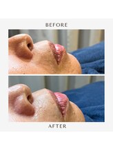 マーク(mark.)/お肌のゴワつき解消！