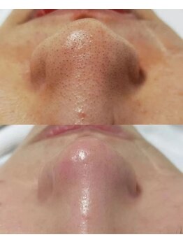 ナチュラ ソース(NatureSouce)/