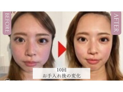 グレースフィオーレ 秋田店(gracefiore)の写真