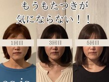 手による施術で輪郭改善♪《草津/小顔矯正/整体》