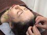NEW【鍼灸】《女性が担当》美容鍼(+電気)+肩首背中鍼+小顔矯正60分¥14000