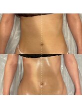 エクラ(eclat)/セルクラ