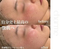 シャルム(Charme)