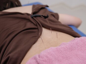 カルミア鍼灸接骨院の写真/子育てをするお母さん、仕事で疲労を感じる方、美容鍼に興味があってサロンを探している方にオススメ☆