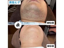 ビューティーサロン マル(Beauty Salon MARU)/