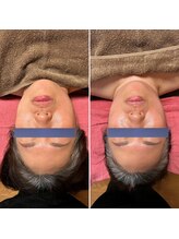 虹のひかり/小顔矯正