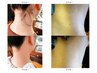 ★うなじ／リンパケア糸脱毛[スレッディング](★¥5500写真ビフォーアフター