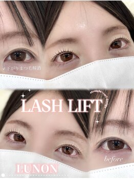 ルノン 草加獨協店(LUNON)/下がりまつ毛解消☆