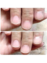 爪屋べっぴん堂/メンズケア