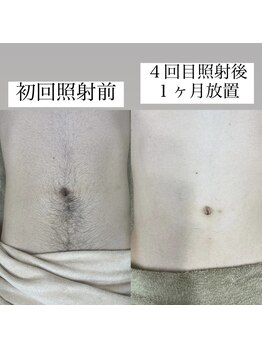 テンパ ビューティー(+10%beauty)/効果写真