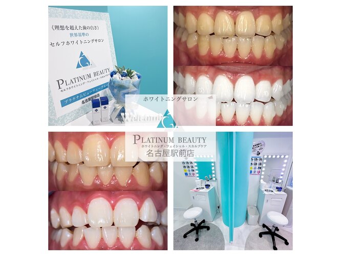 プラチナムビューティー 名古屋店(PLATINUM Beauty)｜ホットペッパー 