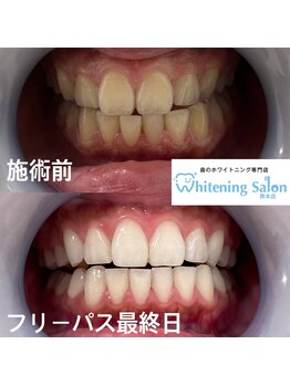 ホワイトニングサロン 熊本店/街中セルフホワイトニング
