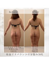 フローラ 自由が丘(Flora)/産後ダイエット・リバウンド