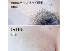 美サロン エモリアント(emoliant)の雰囲気（ワックスと光の効果抜群ハイブリッド脱毛ができるのはここだけ♪）