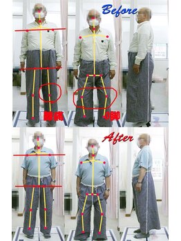 姫路なごみ整体院 なごみ鍼灸院/左ひざの痛みとO脚