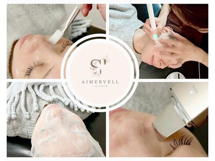 セメヴェール(Saimervell)の写真
