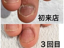 グレースレディ/3回でしっかり伸びてます