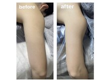 アーチ(AR-CH.)/痩せたい部分を集中施術～上半身