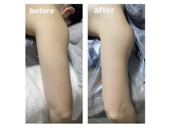 アーチ(AR-CH.)/痩せたい部分を集中施術～上半身