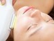 レイネ(Reine)の写真/プロ用の本格的最新機器◎脱毛は【Reine～Total Beauty Salon～】にお任せください＊