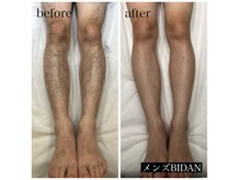 ビダン(BIDAN)の雰囲気（【メンズ脱毛】男の身だしなみは脱毛から。）