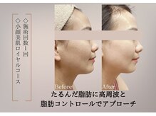 ベラ 東京院(Bella)/輪郭、ピタッとアイロンがけ