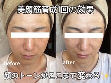 リエル(RIEL)/【美顔筋育成】