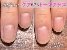 ナル(Nalu.)/ケアだけでも◎