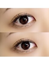 アイル(I'll)/悩みを解決して可愛い目元に！