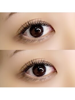 アイル(I'll)/悩みを解決して可愛い目元に！