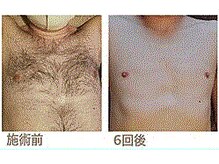 シンバ 南草津店(SIMBA)/【Before→After】