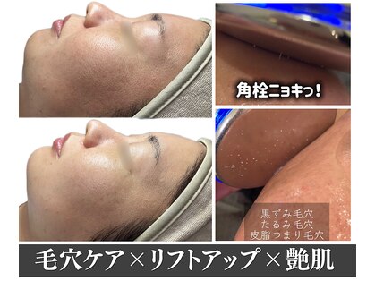アイアム(Iam)の写真