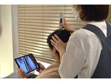 匠(TAKUMI)/頭皮を200倍に拡大して頭皮診断