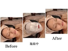 トータルエステティック ライム(lime)/顔たるみ二重あごもう悩まない!!