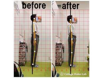 上本町骨盤整体院グッド/「整体による姿勢の変化」