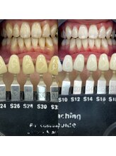 トウキョウスワーズ 池袋店(TOKYO SWRS)/#ホワイトニング #池袋 #渋谷