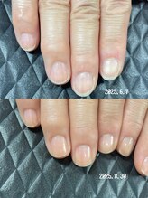 クーラ アンド ベリッシモ(Cura&Bellissimo)/最強ケア3ヶ月集中コース